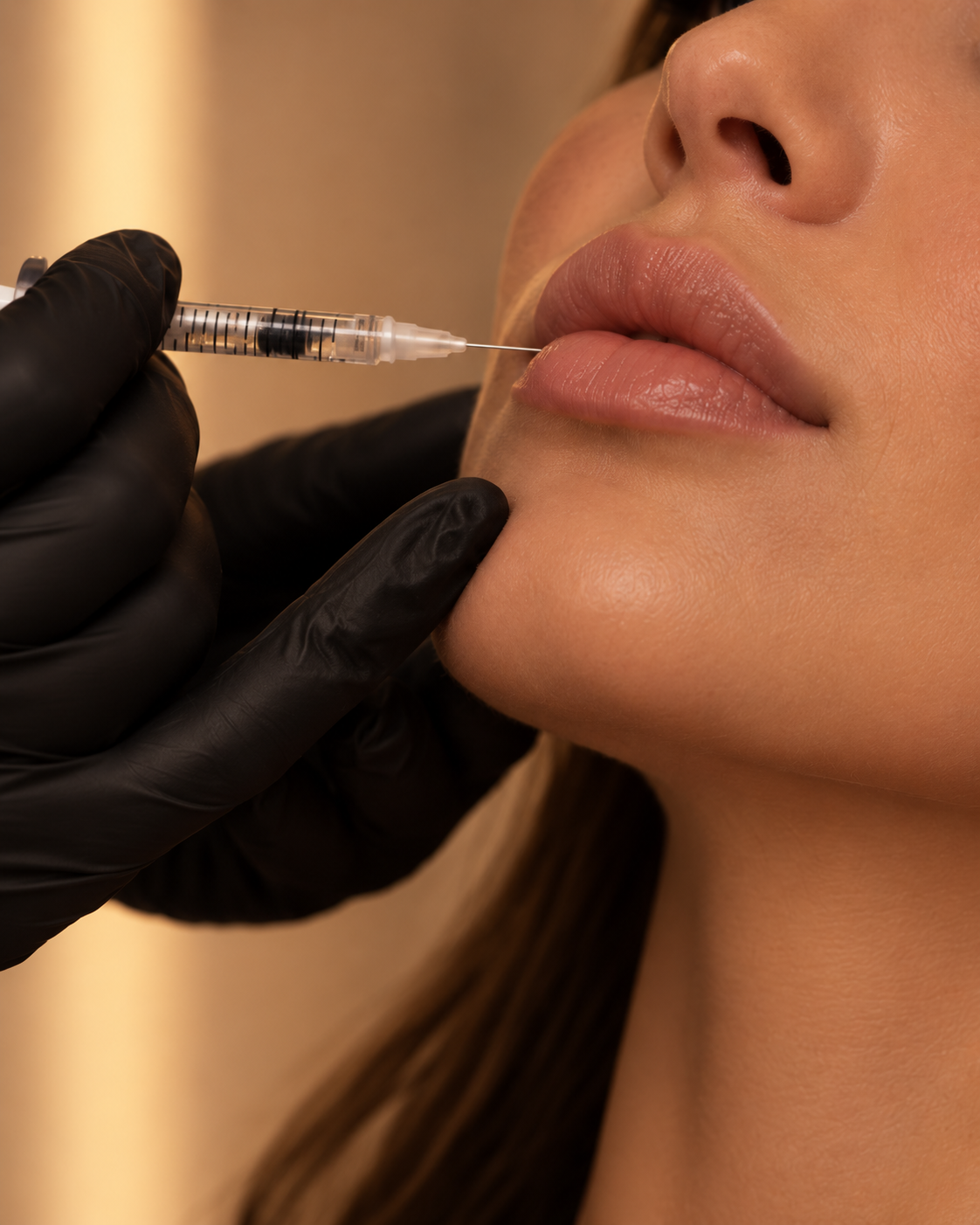 Hyaluron-Behandlung bei MARÉ — sanfte Konturierung für natürlich frische Lippen